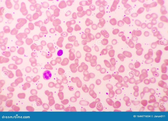 Thrombocyte What is a Thrombocyte? A Deep Dive