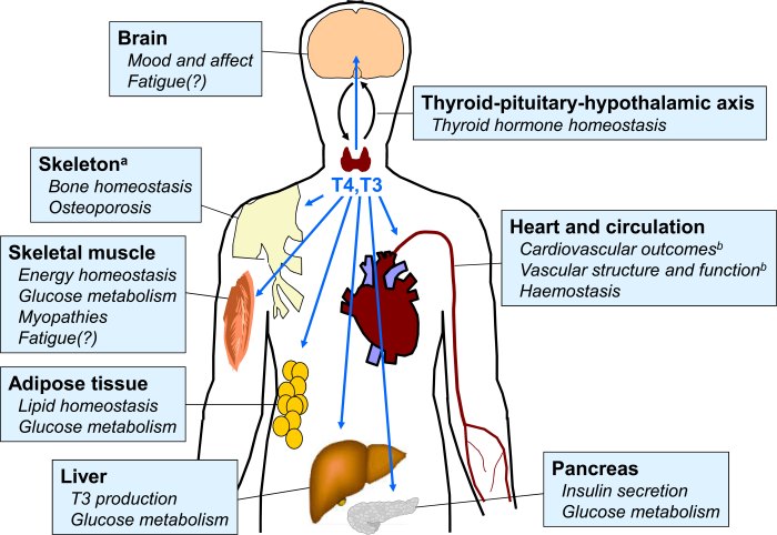 Hyperthyroidism Causes Thyroid peroxidase antibody test
