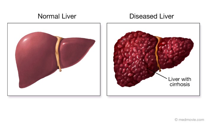 Supplements for liver health