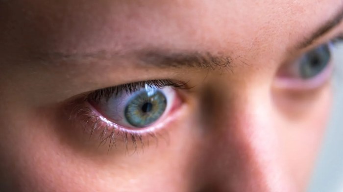 How graves disease is diagnosed