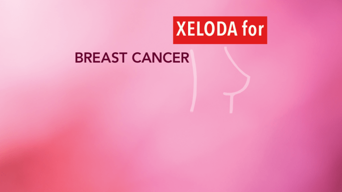 Xeloda for Metastatic Breast Cancer A Comprehensive Guide
