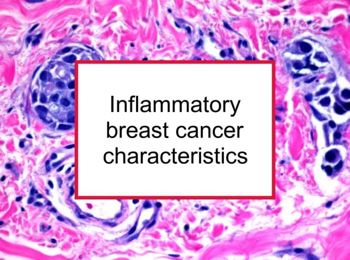 Ibc inflammatory breast cancer