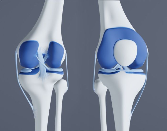 Knee injections for pain