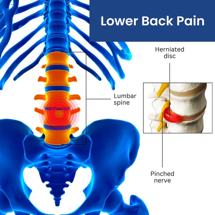 Lower left back pain