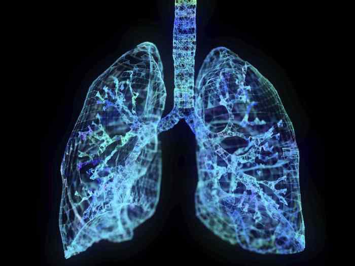 Lung cancer recurrence treatment and prognosis