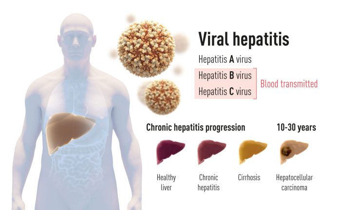Hepatitis c symptoms in males