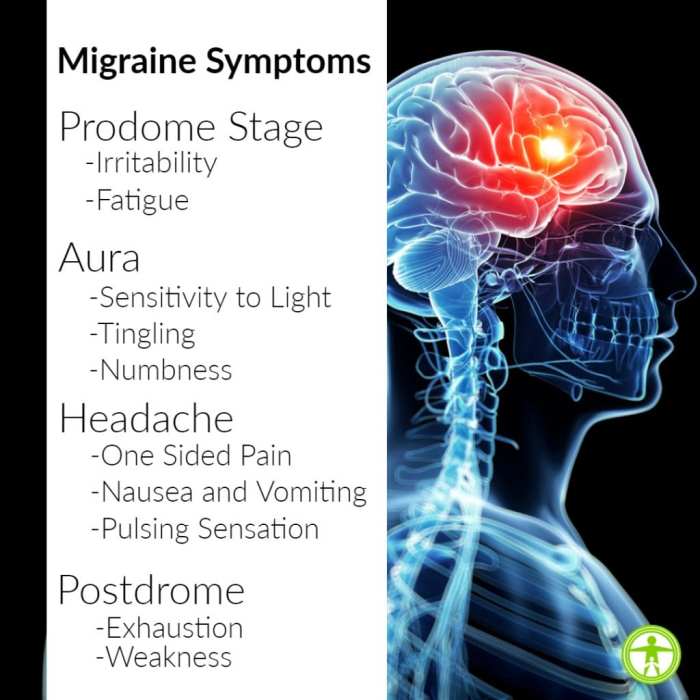 Medication for Treating Migraine A Comprehensive Guide