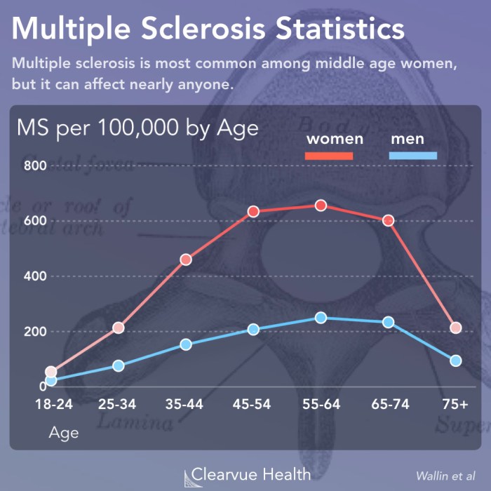 Multiple Sclerosis in 4 Charts | Visualized Science Multiple sclerosis ms prevalence and incidence