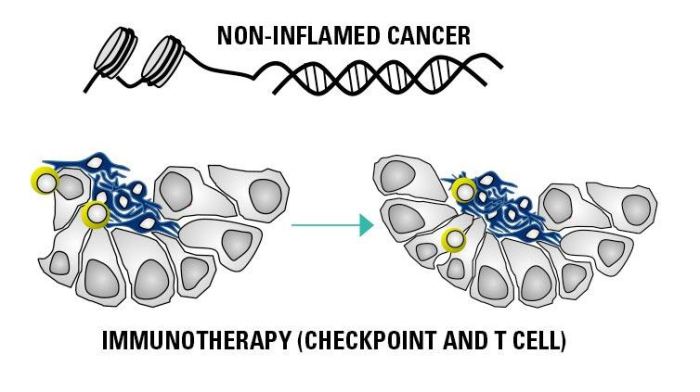 Immunotherapy drug shrank cancer tumors without surgery
