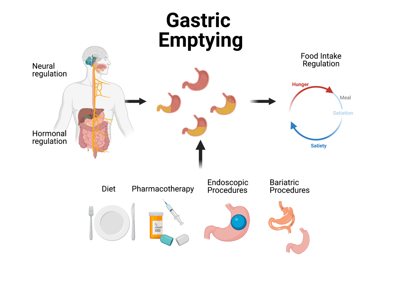 Gastric bypass surgery recovery