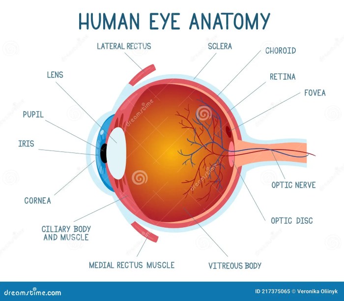 Melanoma of the eye