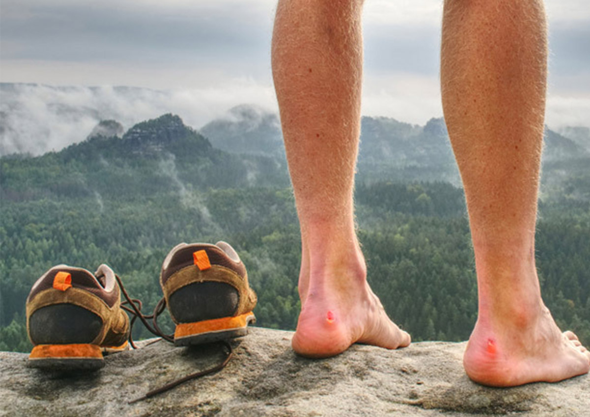 When and How to Safely Pop a Blister Should i pop a blister