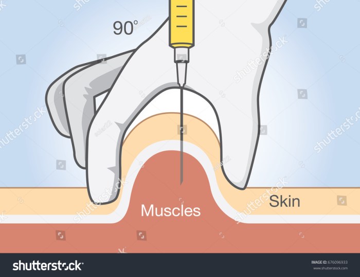 Intramuscular injections progesterone oil