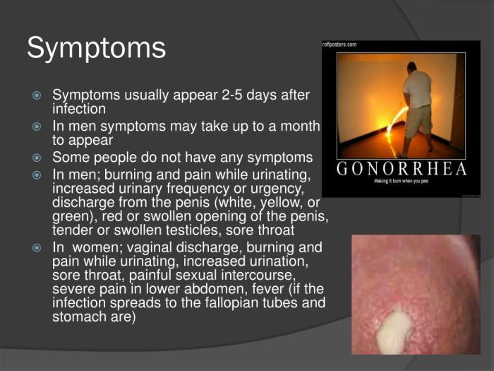 Gonorrhea: What’s Currently in the Clinical Pipeline? - The Native Antigen Company Gonorrhea symptoms after treatment