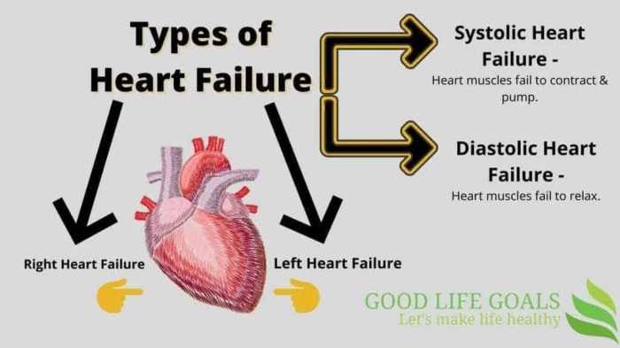 Types of Heart Failure A Comprehensive Guide