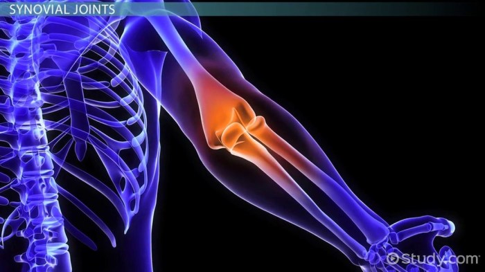 What is a Joint Subluxation? Explained
