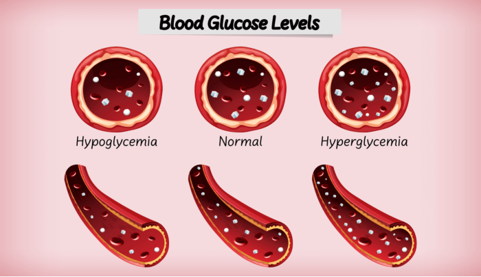 Hypoglycemia Causes Hypoglycemia causes risk factors
