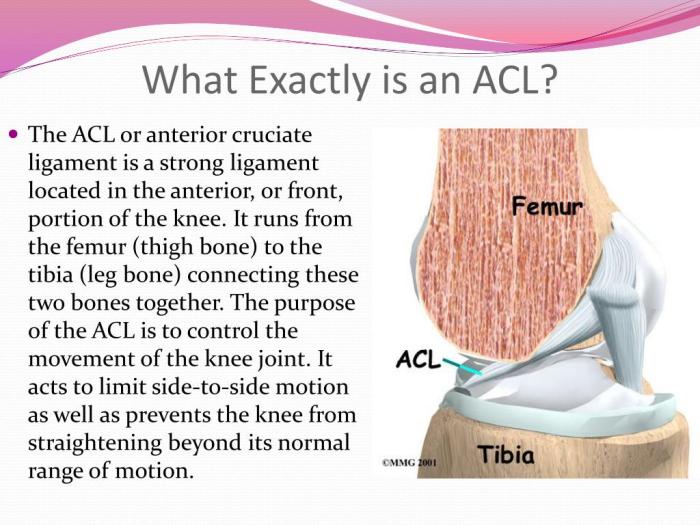 এসিএল ইনজুরি (ACL injury) প্রকার কারণ উপসর্গ ও প্রতিরোধ Acl tear surgery rehab how long does does it take