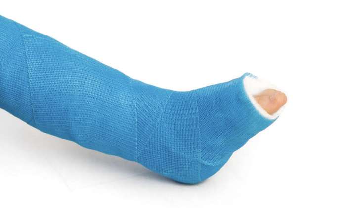 What is charcot foot