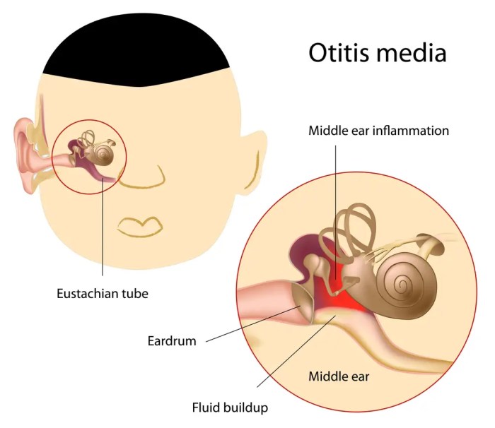 What is Causing My Ears to Ring? A Deep Dive