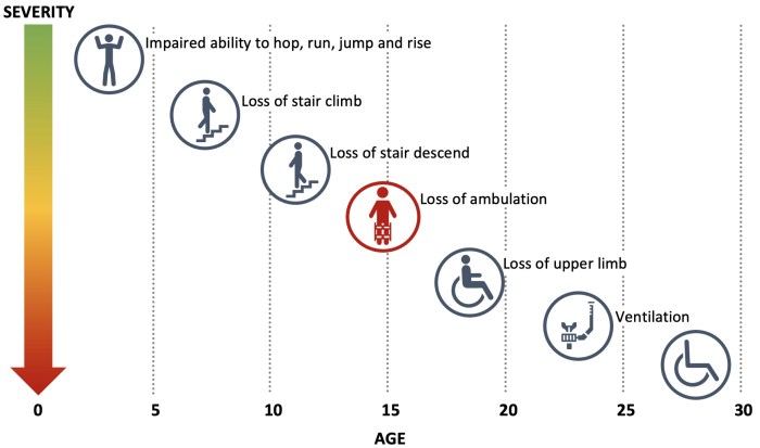 Duchenne muscular dystrophy overview