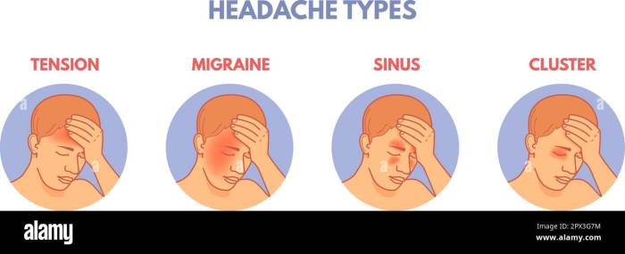 Handy Charts to Help Deal with Migraines | Health - BabaMail Migraine relief pressure points