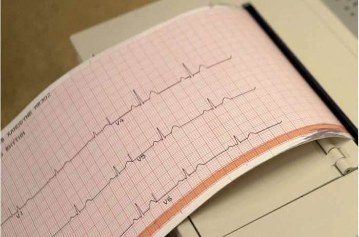 New, old drugs may offer fresh ways to fight heart disease Ask an expert when should prescription drugs be used to heart disease