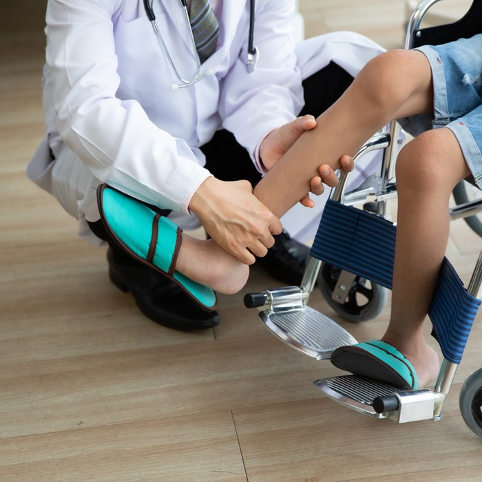 Duchenne muscular dystrophy overview