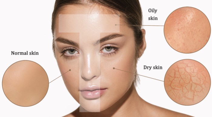 Dermis Layer Skin cancer and rash