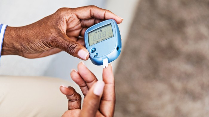 Diabetes - Types, Symptoms, Causes, Complications and Prevention Diabetes and skin problems