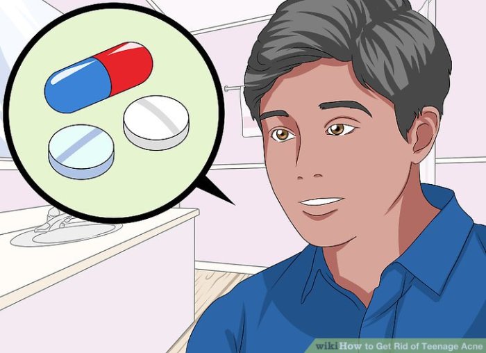 Teenage Acne Cure Prevent - Stylish Walks Keep teen acne to a minimum