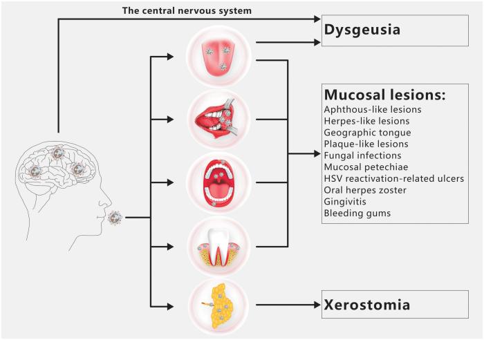 Oral bacteria colorectal cancer risk
