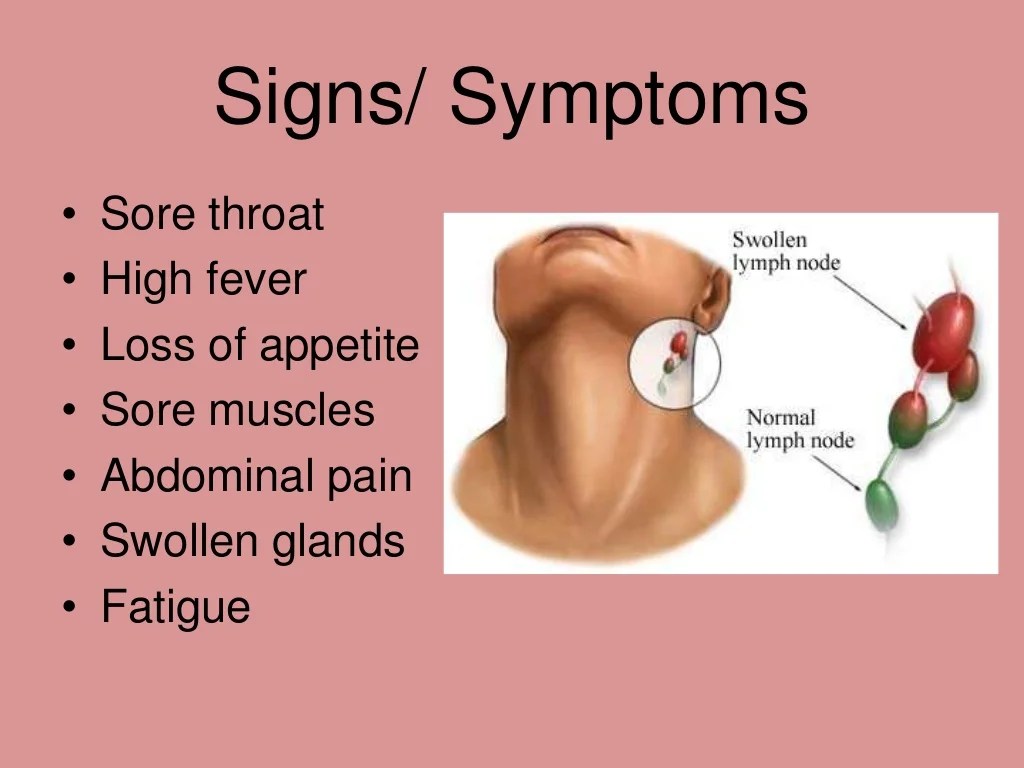 How is mono diagnosed