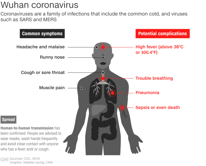 A New Chapter of the Coronavirus - The New York Times Covid rapid test line color