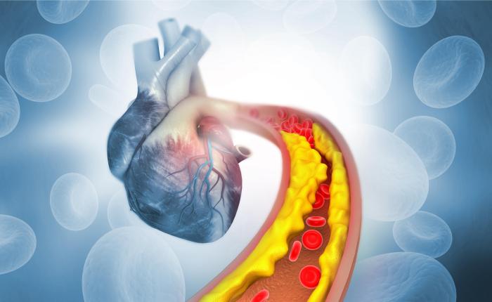Understanding Your Test Results: LDL Cholesterol — Fitness Lab Testing ... Drugs for cholesterol and triglycerides