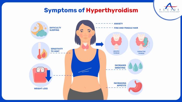 Hyperthyroidism symptoms in females