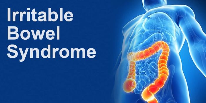 Irritable bowel syndrome ibs