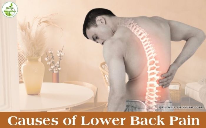 Causes of Low Back Pain Lower back pain causes