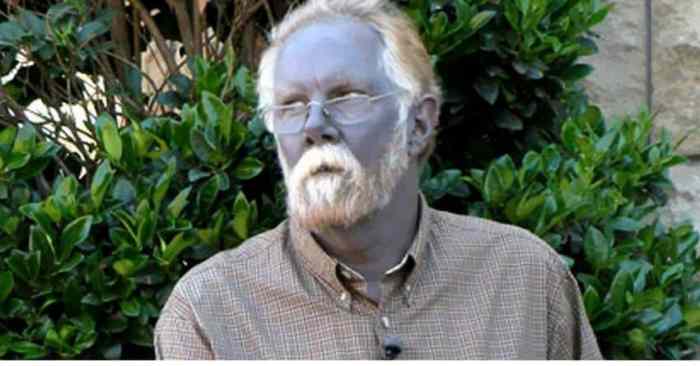 Colloidal silver blue skin cause