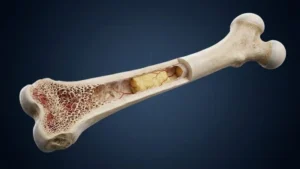 Bone marrow macrophage STING signaling is a direct nexus linking marrow adipose expansion to NAD⁺ depletion and osteogenic decline in skeletal aging